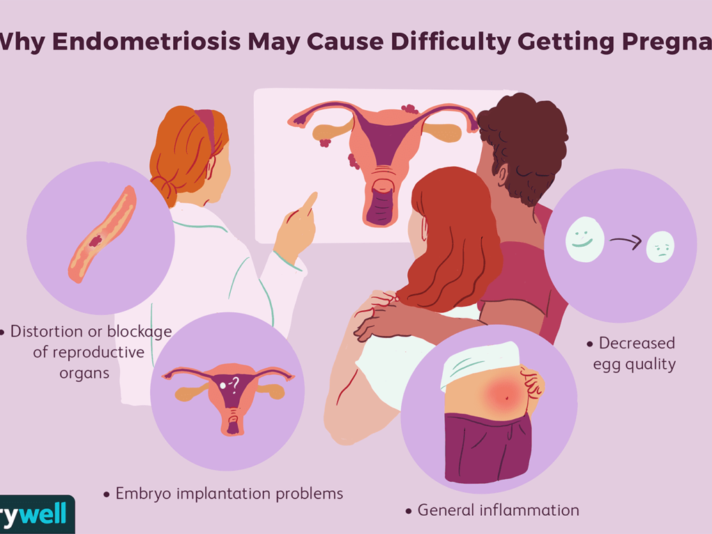 Endometriosis Test